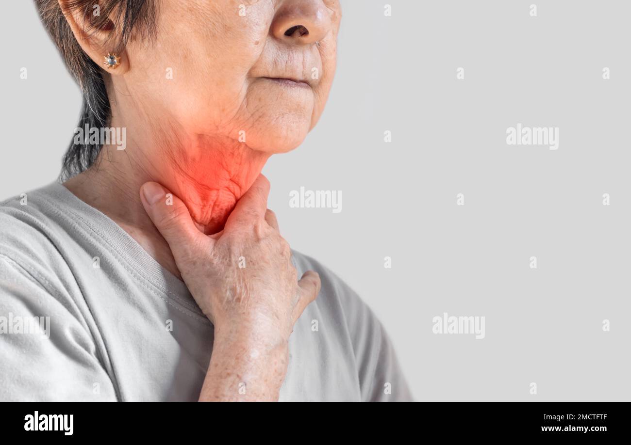 Arrossamento al collo di asiatico, donna Myanmar. Concetto di mal di gola, faringite, laringite, esofagite, tiroidite, o disfagia. Foto Stock