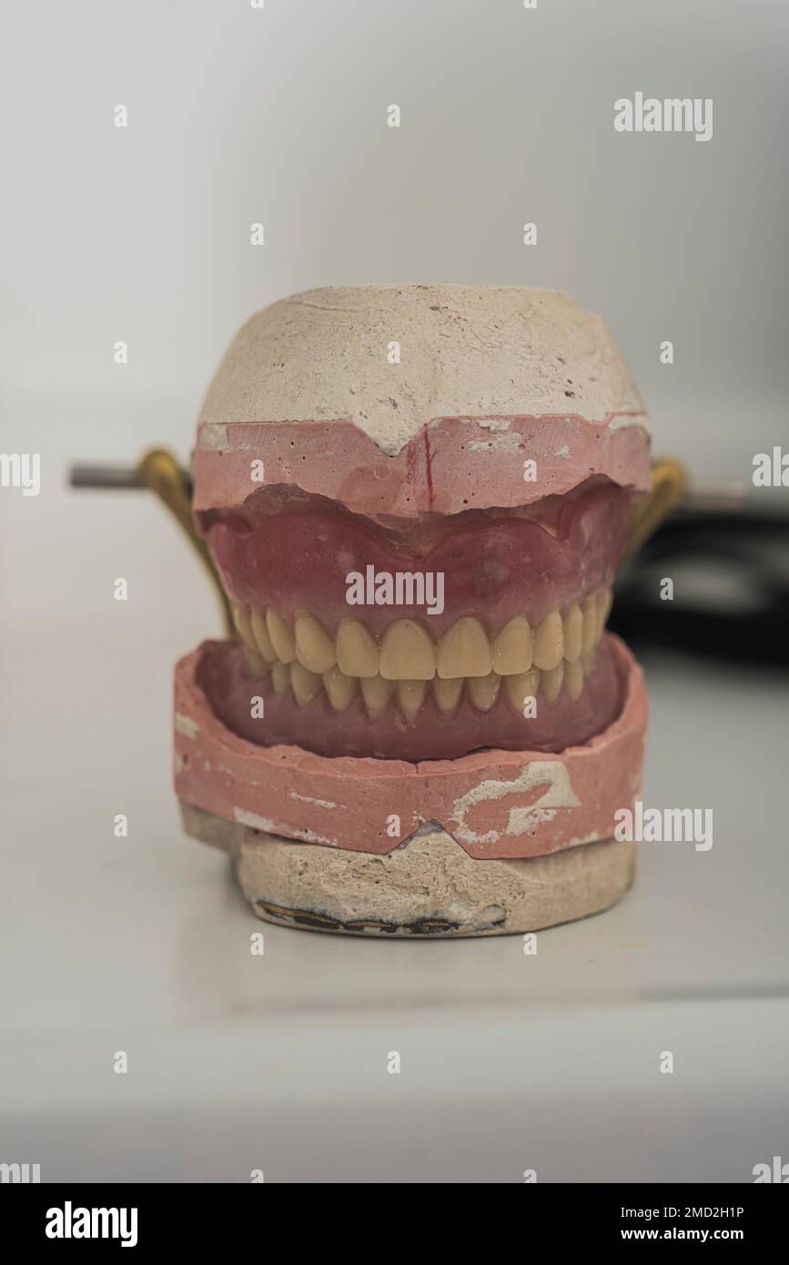 l'immagine di una dentiera in gesso sotto forma di stampo sul tavolo del dentista nella clinica dentale in attesa di essere controllata dal paziente Foto Stock