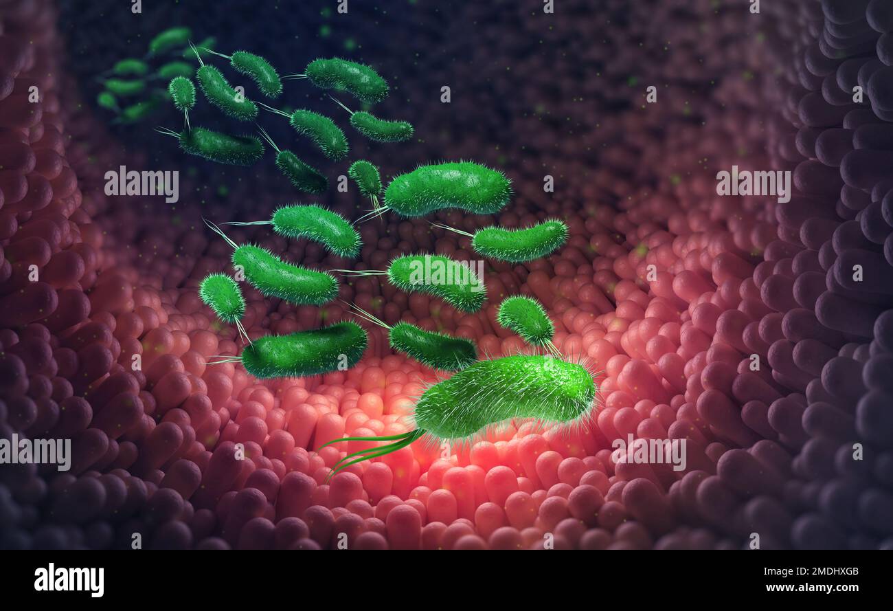 Escherichia coli, germi e virus nel corpo. Infezione intestinale, disturbi di stomaco. Pareti intestinali e infiammazione virale al microscopio. 3D illustrati Foto Stock