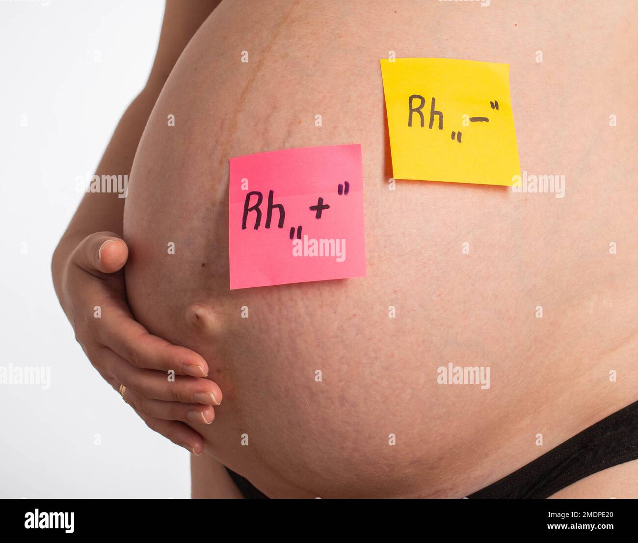 Adesivi sul ventre di una ragazza incinta con iscrizioni negative e positive fattore RH. Concetto di compatibilità del fattore RH, conflitto RH. Primo piano Foto Stock