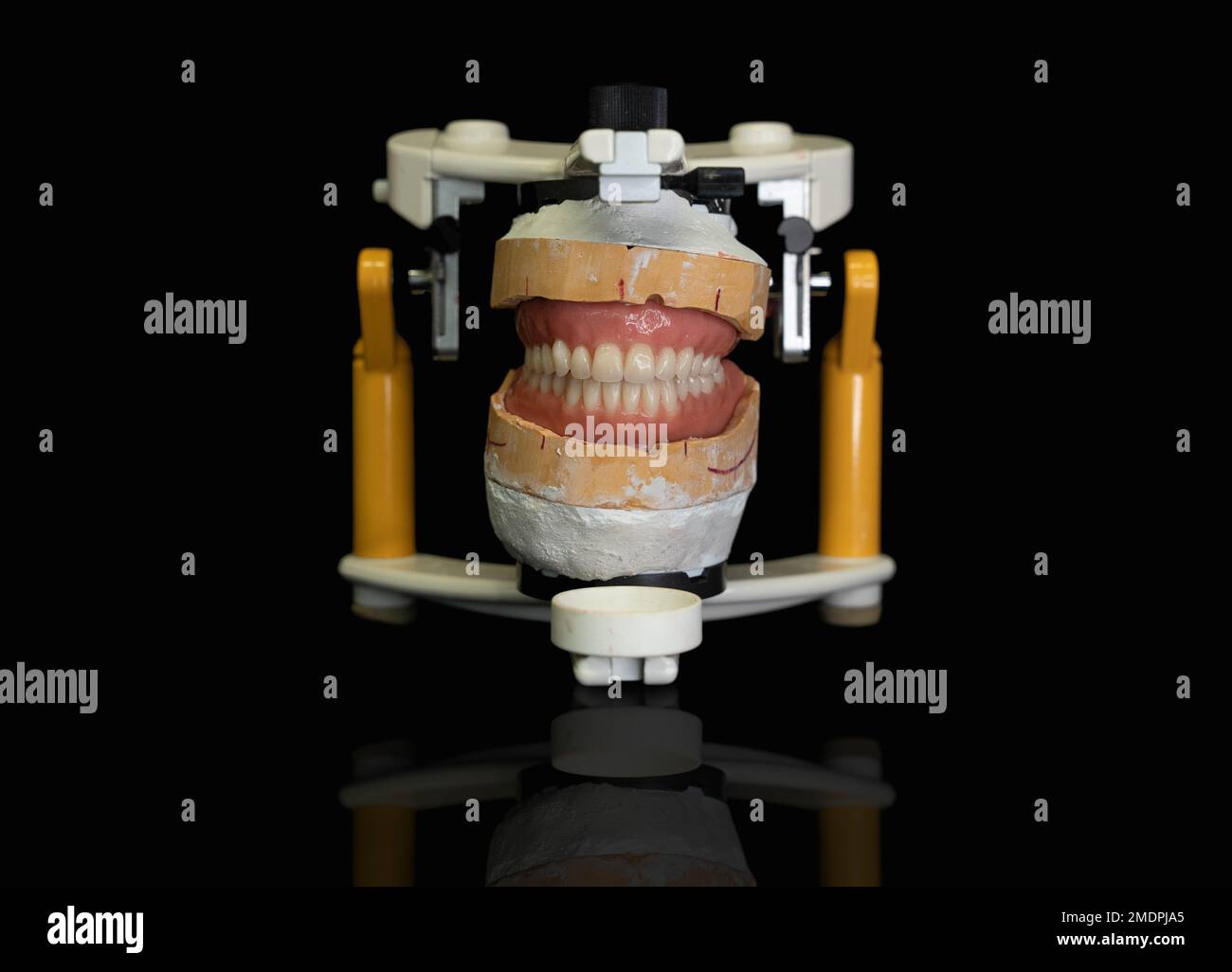 Denti Protesi nella parte anteriore dell'articolatore Foto Stock