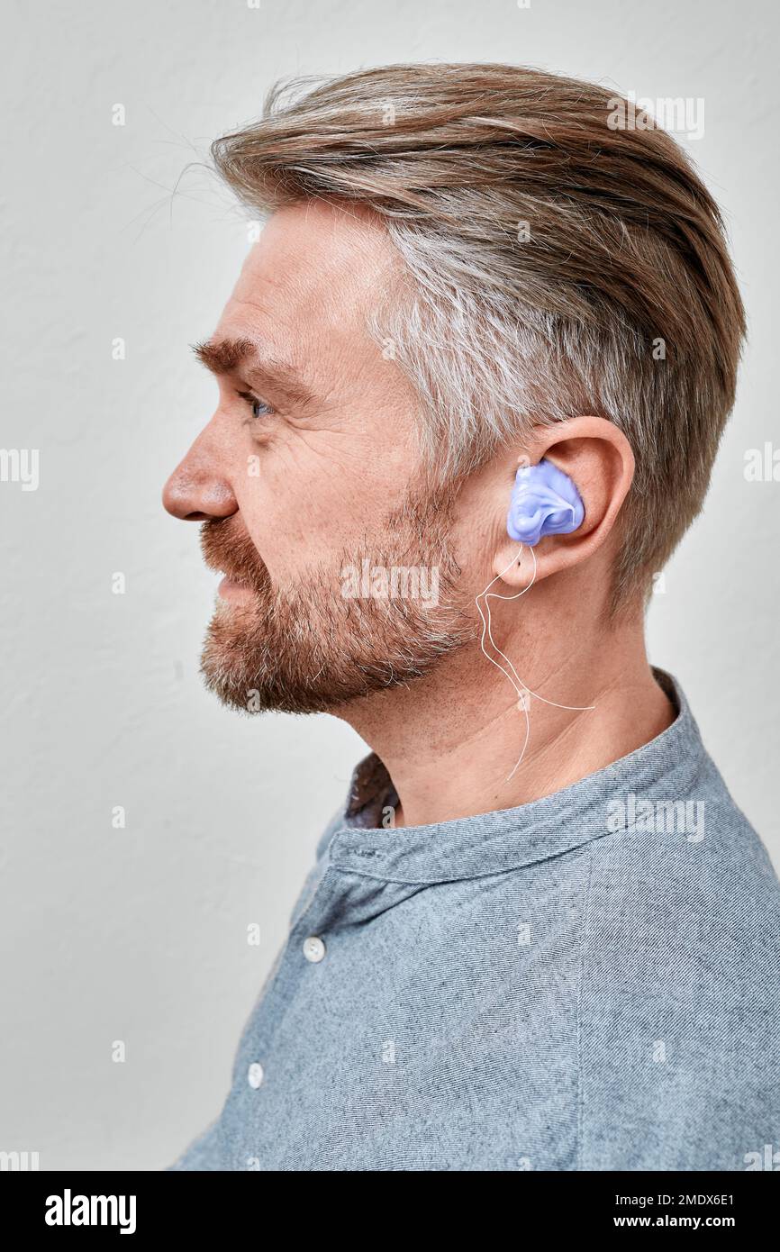 Paziente maschio durante la procedura di fare gli auricolari alla forma individuale del suo orecchio per l'assistenza all'udito in clinica audiologica. Creazione di stampi auricolari personalizzati Foto Stock