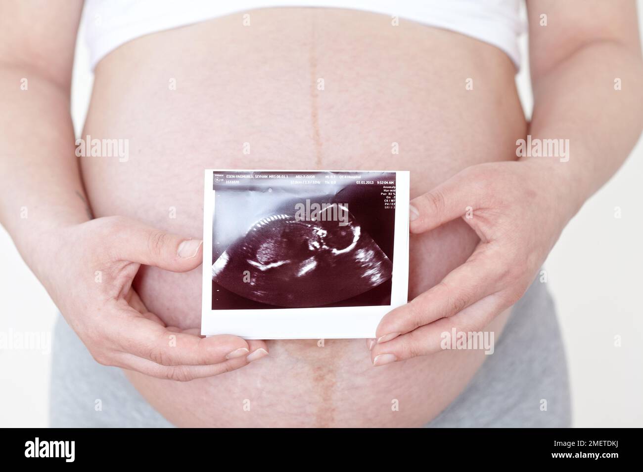 Donna incinta che tiene la scansione ecografica sopra la sua pancia Foto Stock