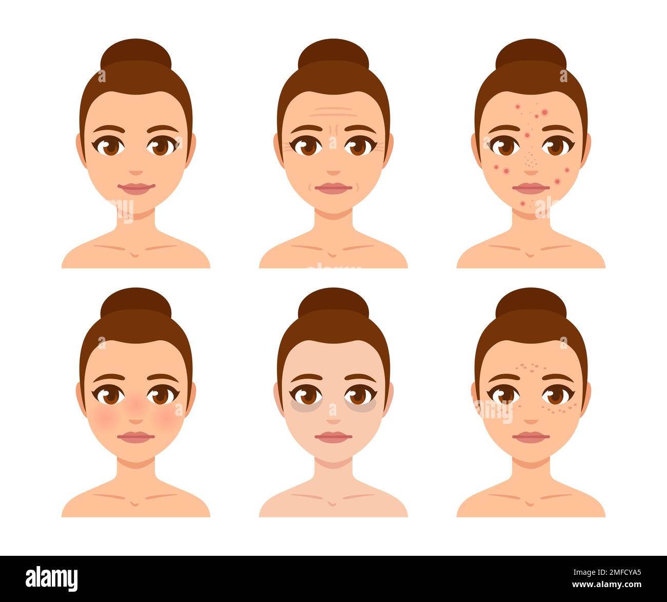 Giovane donna faccia con problemi di pelle. Rughe, acne, macchie di pigmentazione, cerchi scuri. Illustrazione della salute e della bellezza, set vettoriale per la cura della pelle. Illustrazione Vettoriale