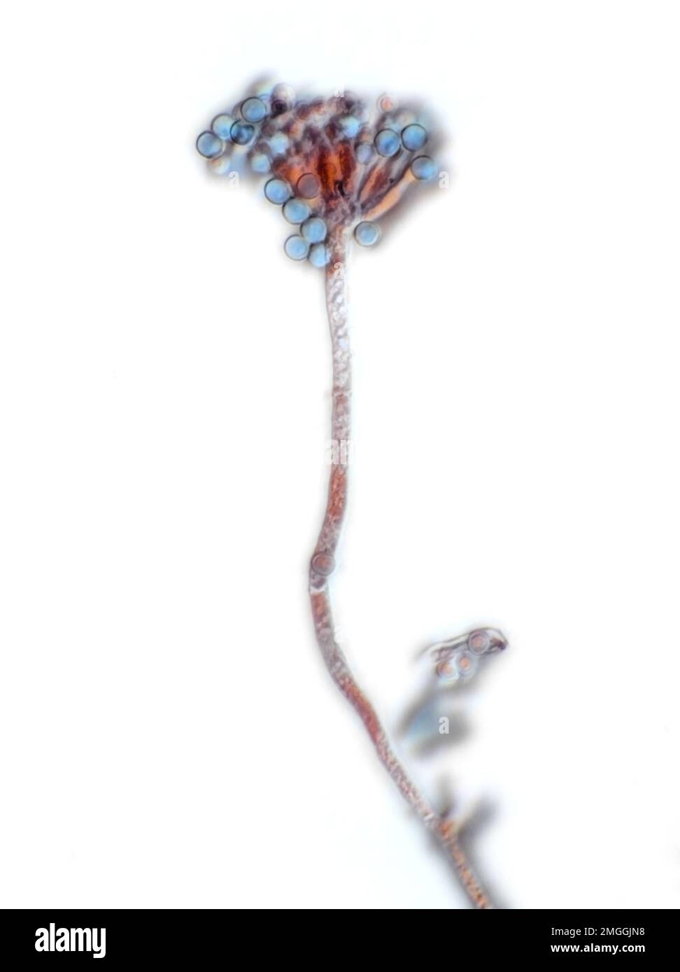 Micrografia a campo luminoso della muffa Penicillium Foto Stock