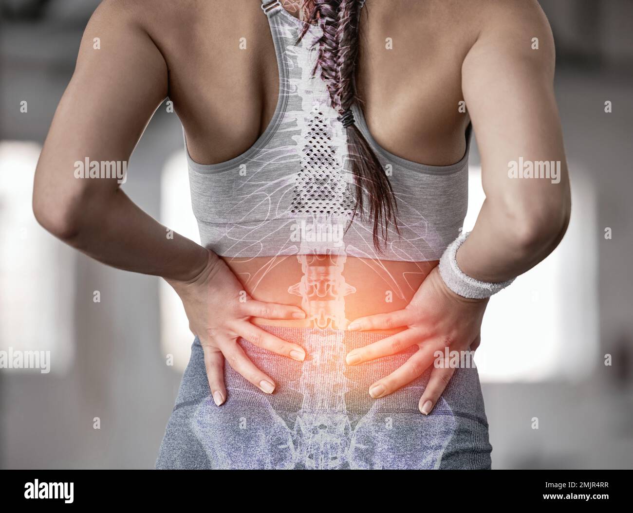 Colonna vertebrale, anatomia e schiena di una donna con dolore durante il fitness, l'allenamento e l'esercizio fisico con un problema. Raggi X, medici e atleti con lesioni o incidenti Foto Stock