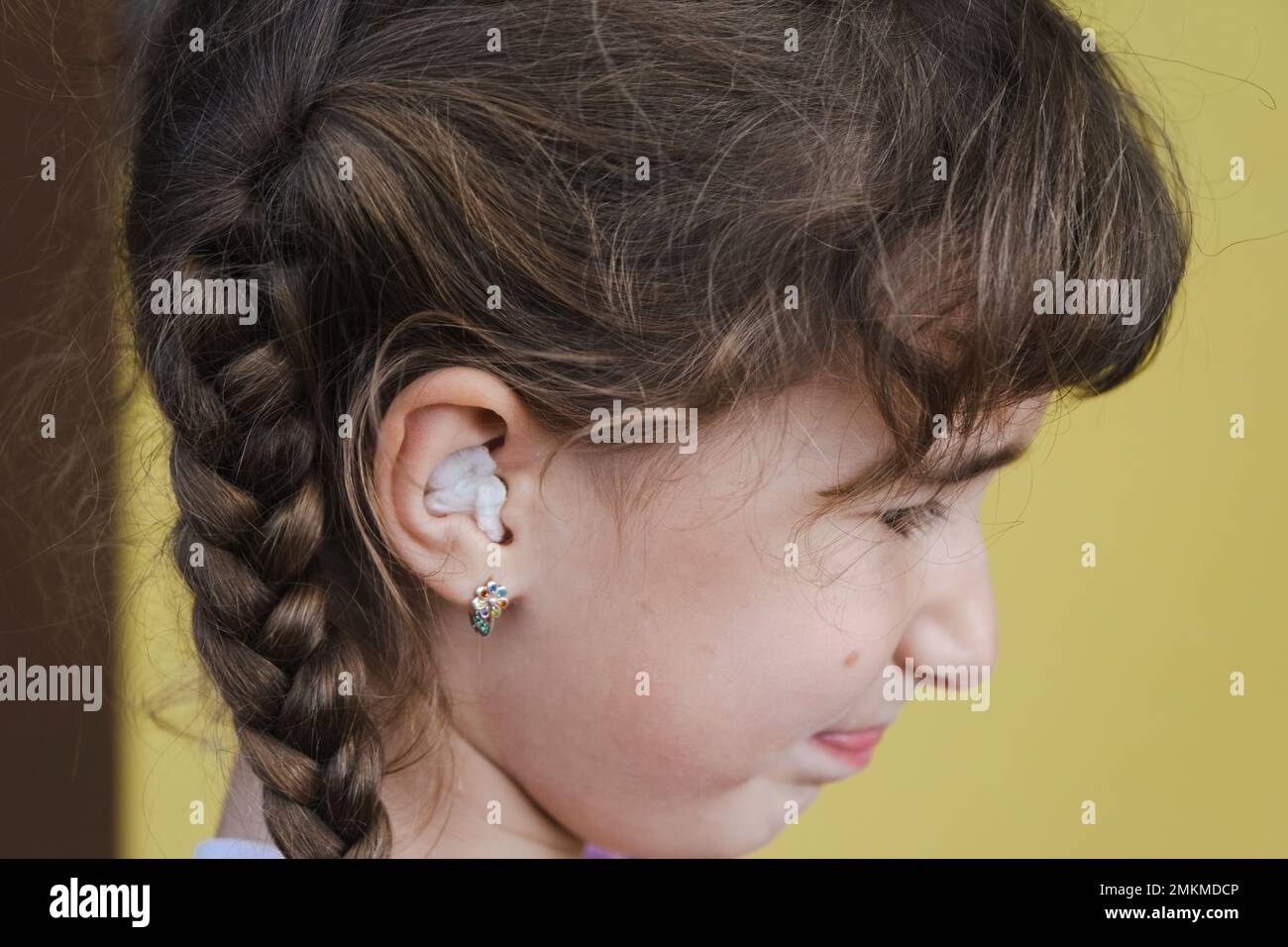 Ragazza con un caldo bastoncino di cotone terapeutico nell'orecchio con un viso triste e terzoso sta tenendo l'orecchio. Dolore all'orecchio, otite media, gonfiore della guancia, gengive Foto Stock