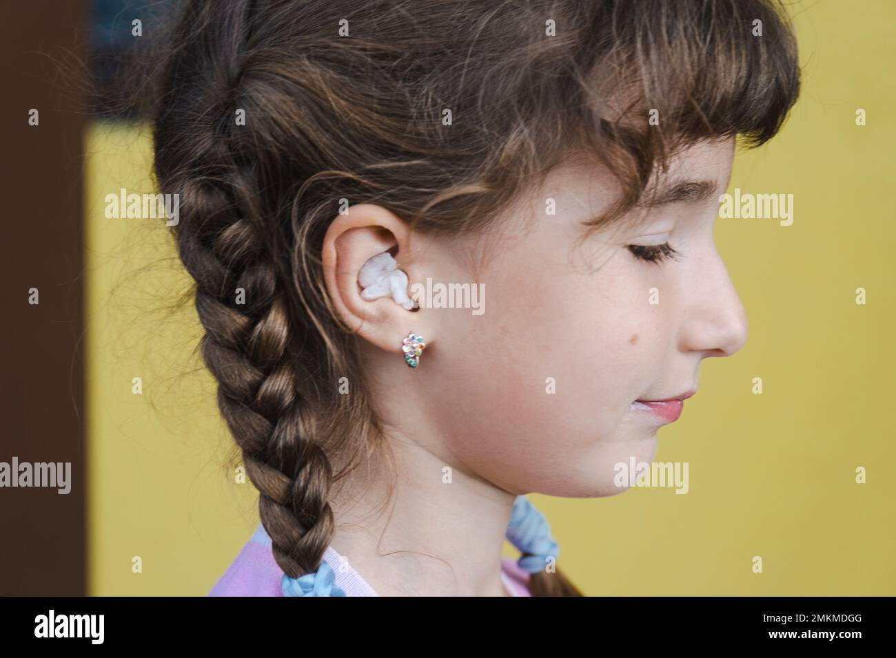 Ragazza con un caldo bastoncino di cotone terapeutico nell'orecchio con un viso triste e terzoso sta tenendo l'orecchio. Dolore all'orecchio, otite media, gonfiore della guancia, gengive Foto Stock
