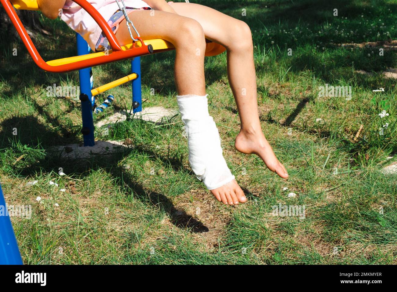 Le gambe dei bambini sono fasciate in gesso - a piedi nudi su un altalena. Attrezzature traumatiche, lesioni ai bambini, lividi, spruzzo, frattura Foto Stock