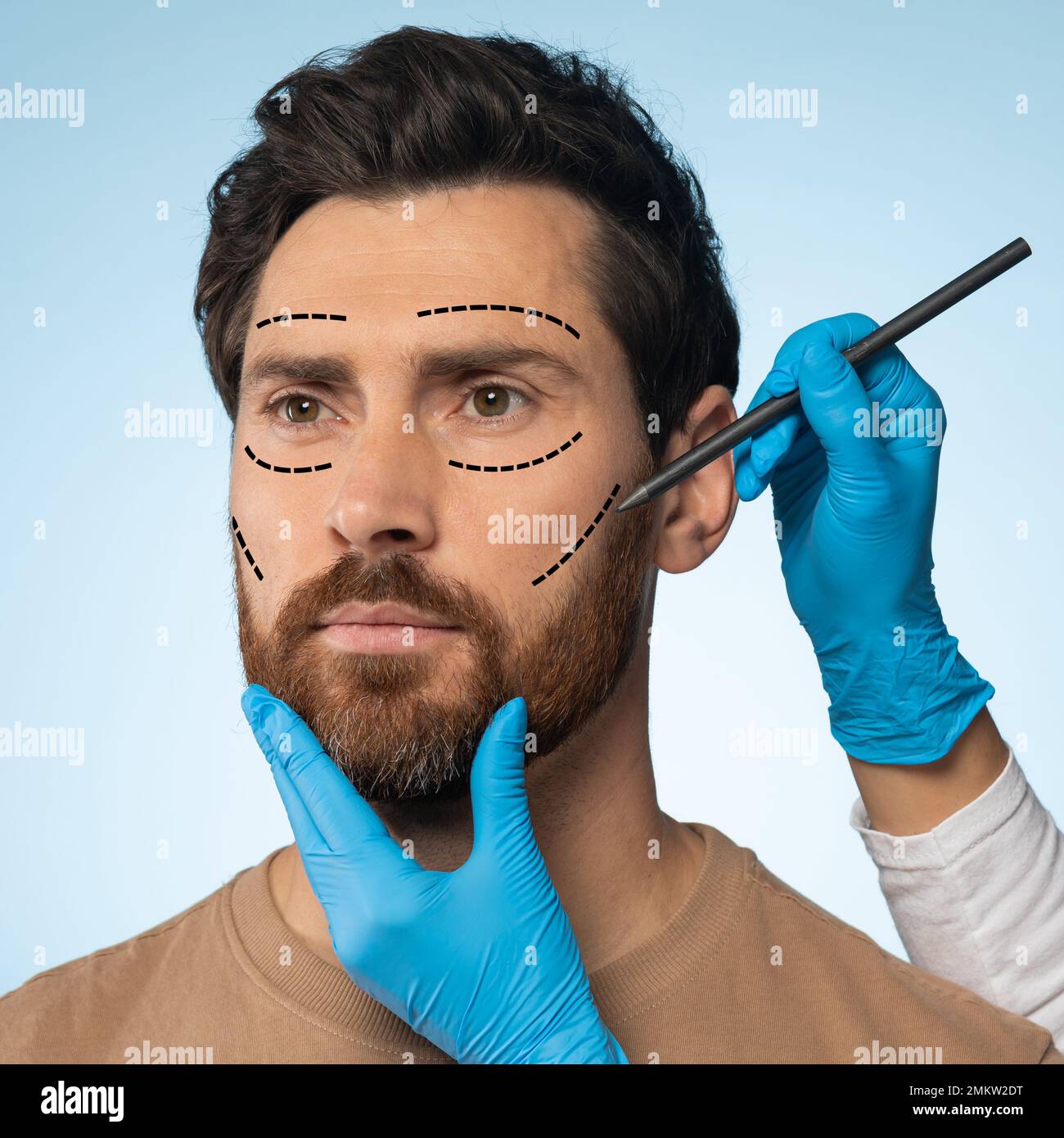 Uomo di mezza età che ottiene segni di matita sulla pelle del viso per la  chirurgia estetica, pronto per l'operazione, sfondo blu Foto stock - Alamy