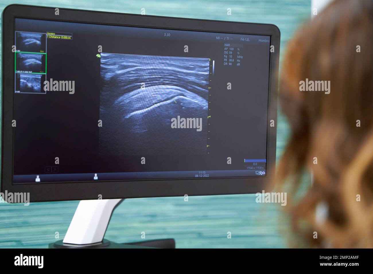Primo piano di una dottoressa che guarda il monitor delle apparecchiature ecografiche. Concetto di medicina e salute. Foto Stock