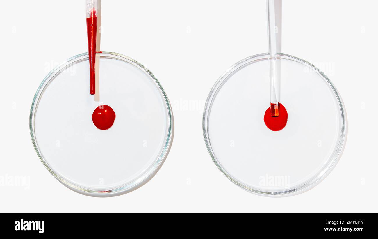 Diversi piatti Petri su sfondo chiaro. Una goccia di sangue. Test di laboratorio, dna, analisi del sangue, laboratorio. Foto Stock