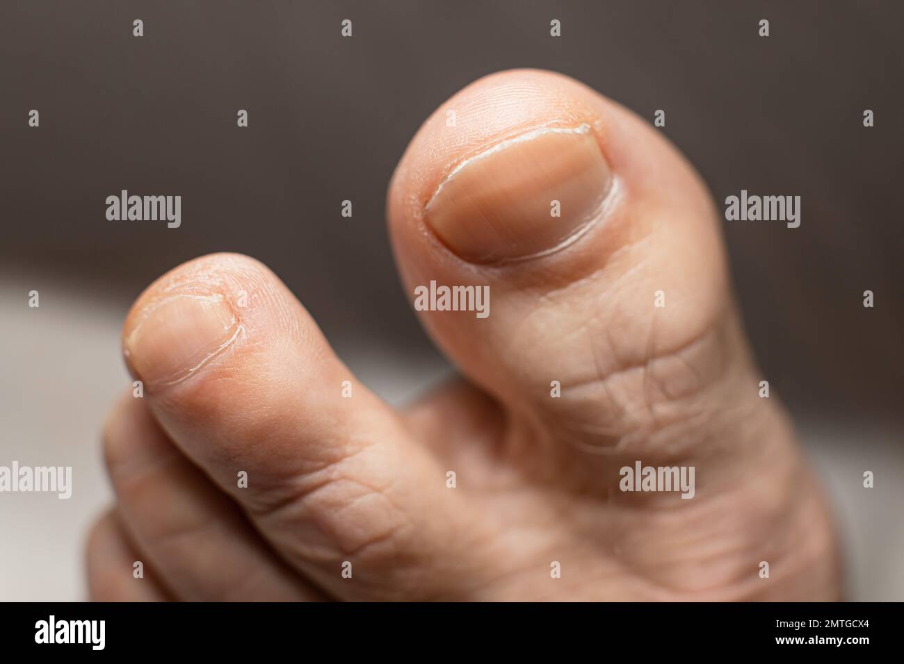 Le dita dei piedi dell'uomo anziano - pelle asciutta - sfondo sfocato poco profondo della messa a fuoco Foto Stock