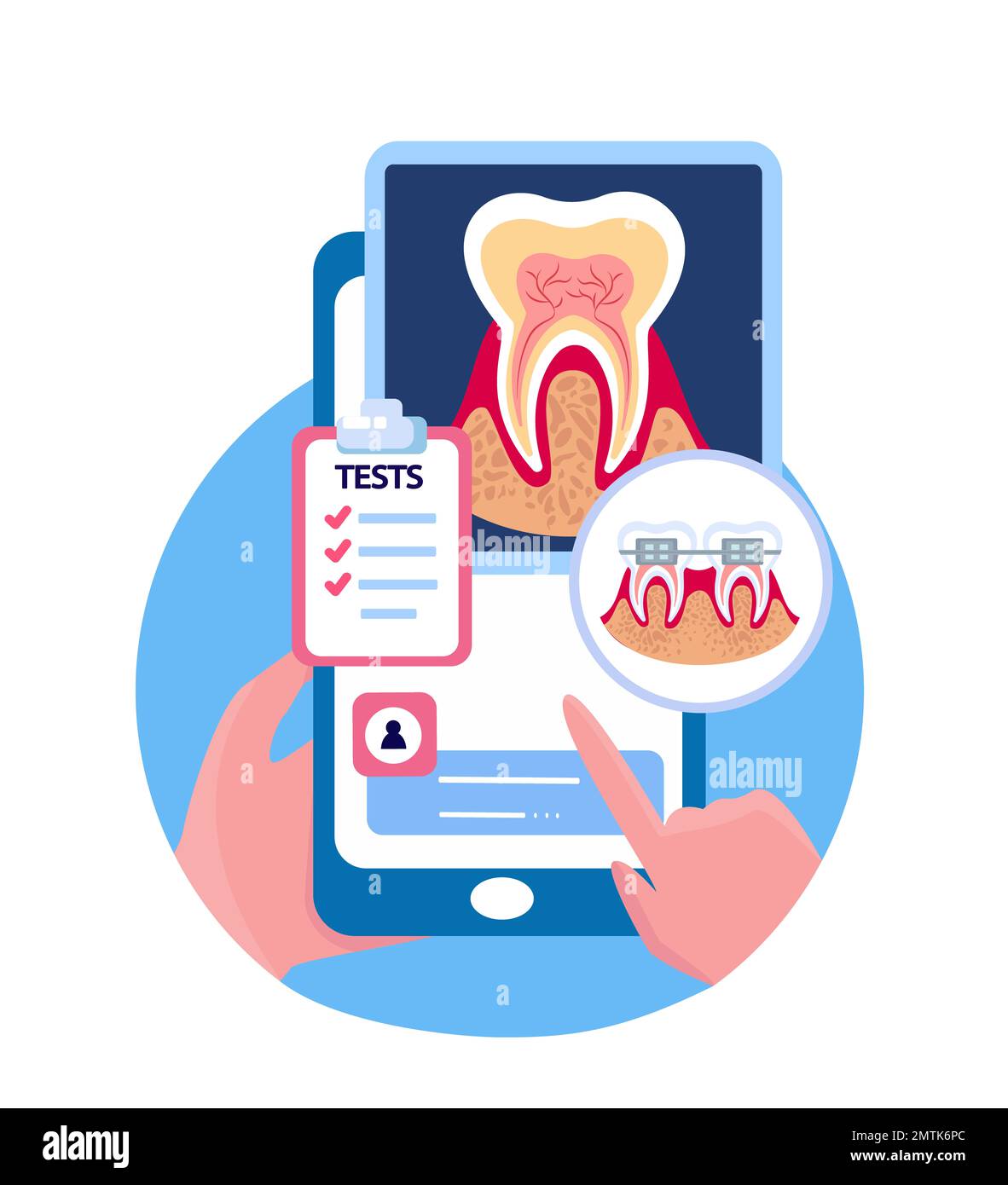 Touch screen online Stomatology Mobile Application.smartphone dentario radiografia a raggi X, Rontgen Test.Clinic Consultation,Medical.Internet Diagnosi Foto Stock