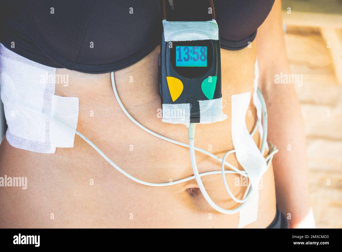 Donna monitor holter ECG tracolla cavi patch tempo Foto Stock