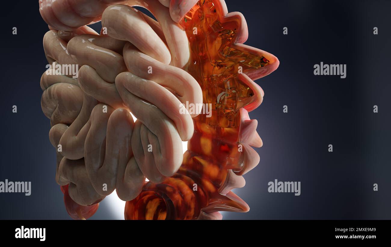 anatomia dell'apparato digerente umano, concetto dell'intestino, diverticolite, resa 3d Foto Stock