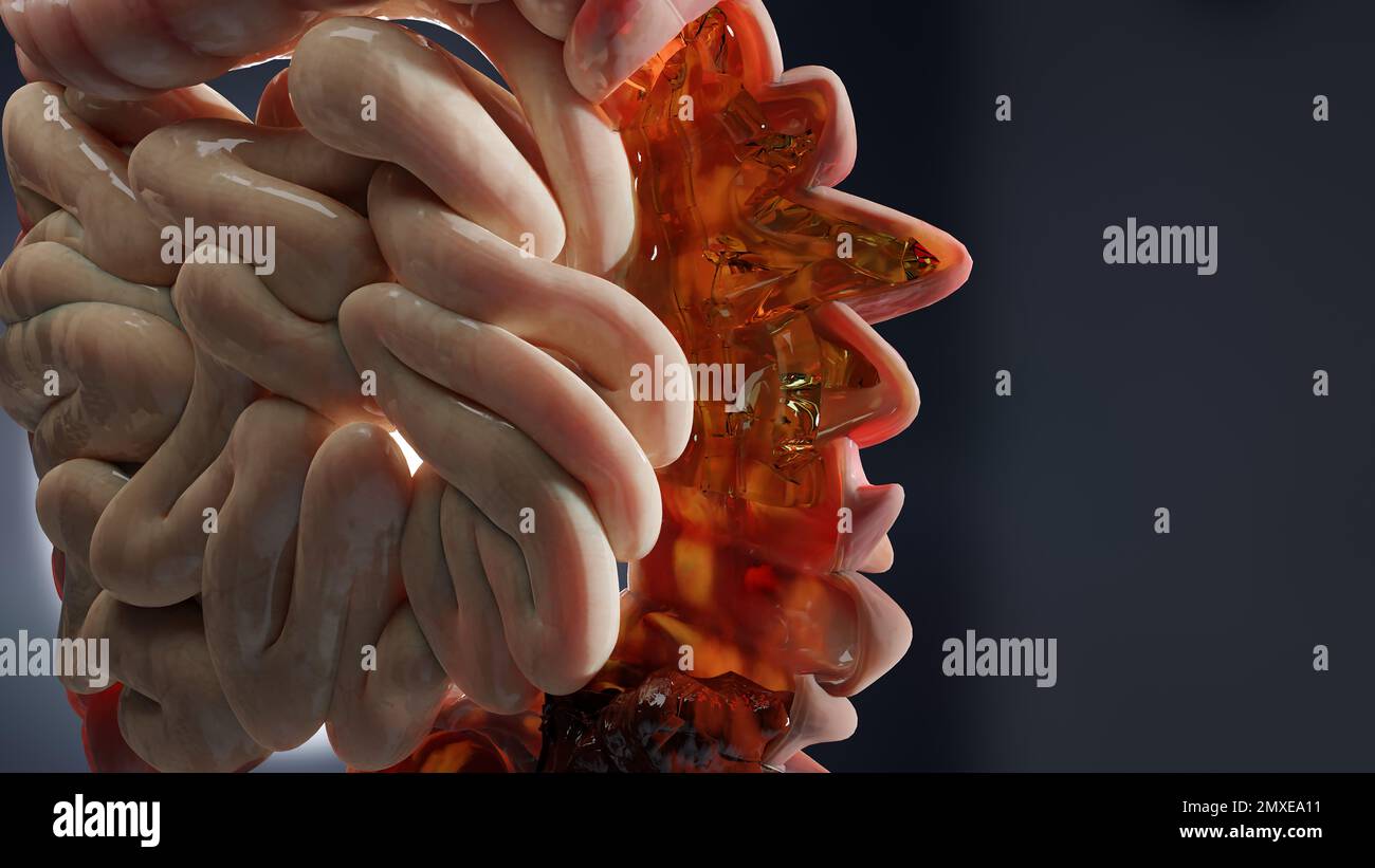 anatomia dell'apparato digerente umano, concetto dell'intestino, diverticolite, resa 3d Foto Stock