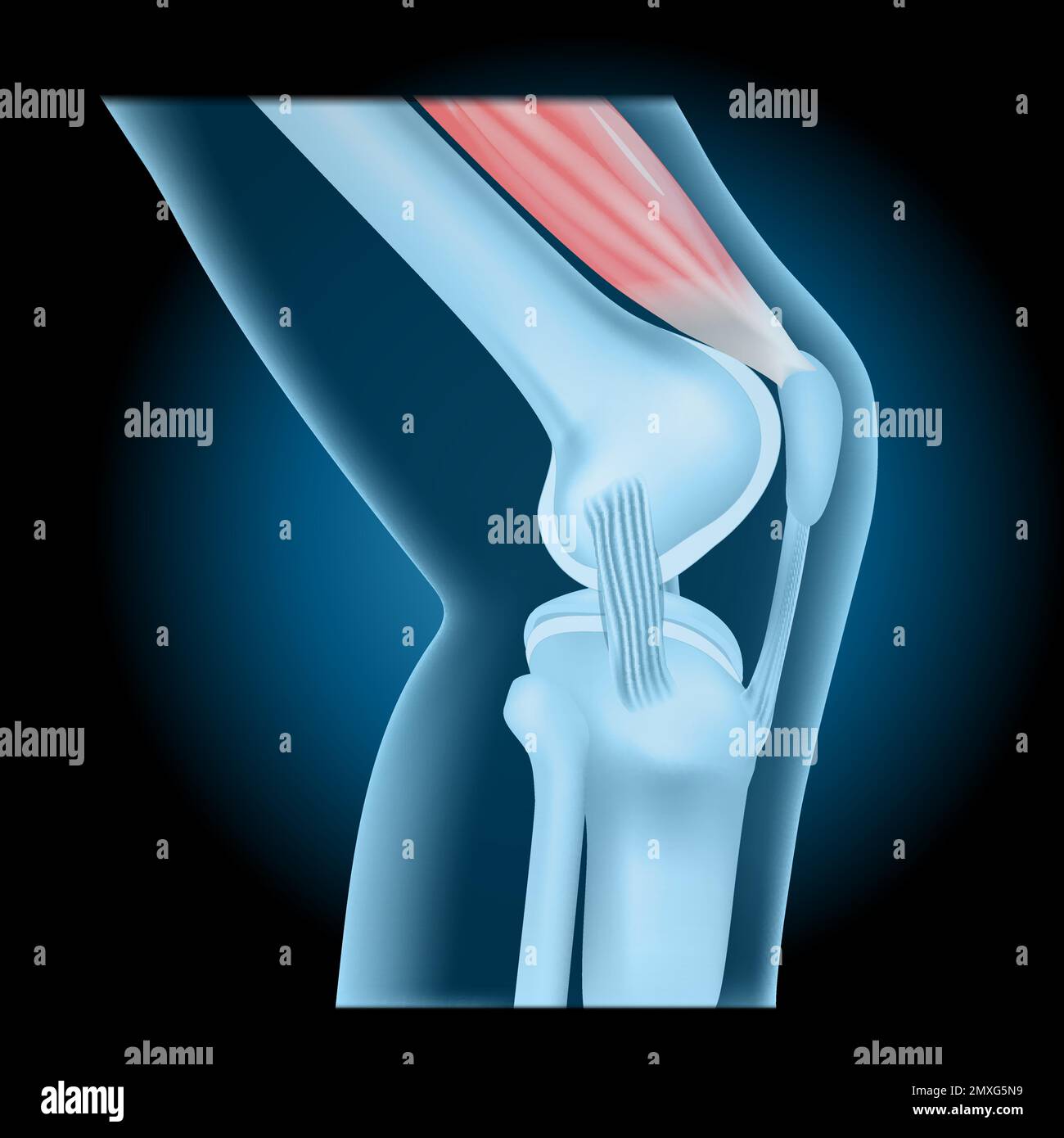 Articolazione del ginocchio con quadricipite. vista laterale del ginocchio umano con effetto incandescente. Giunto blu trasparente realistico su sfondo scuro. illustrazione vettoriale Illustrazione Vettoriale