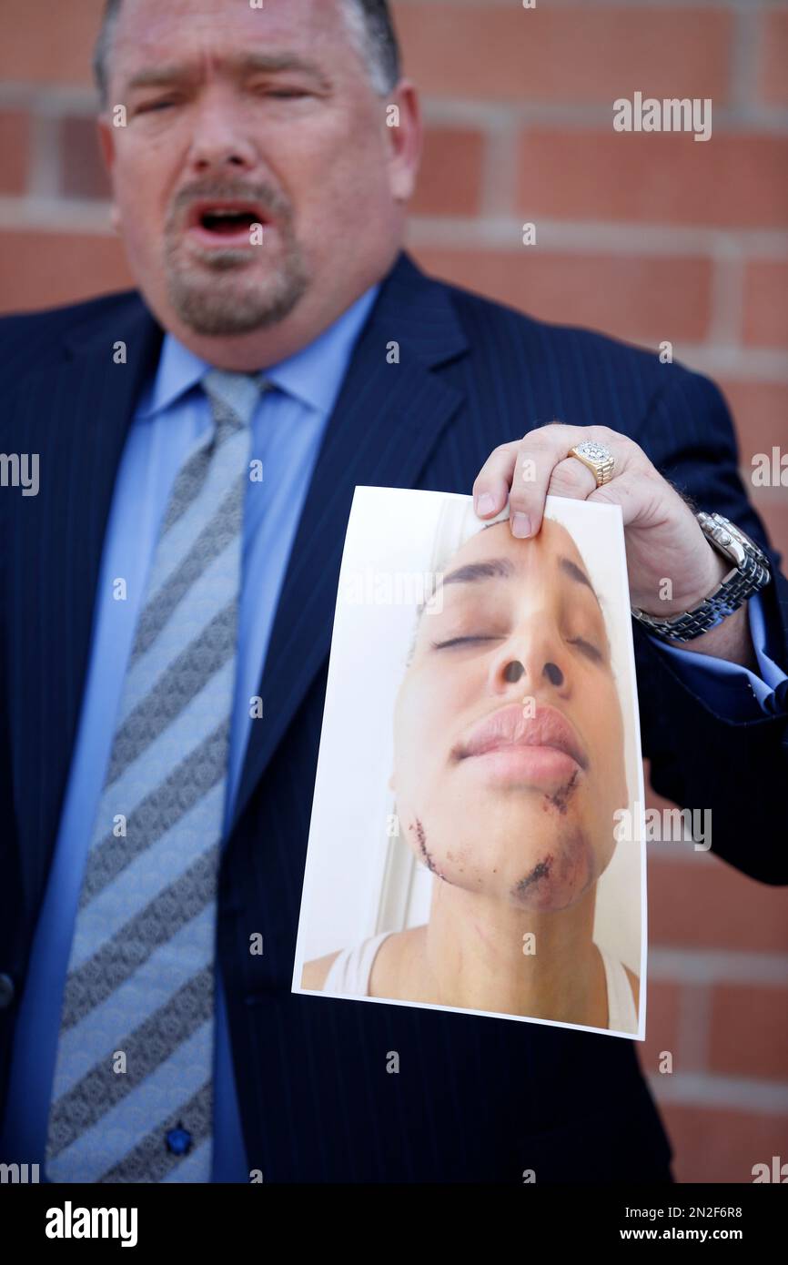 Attorney E Brent Bryson Holds Up A Picture Of Ariana Mason During A News Conference Thursday 4842