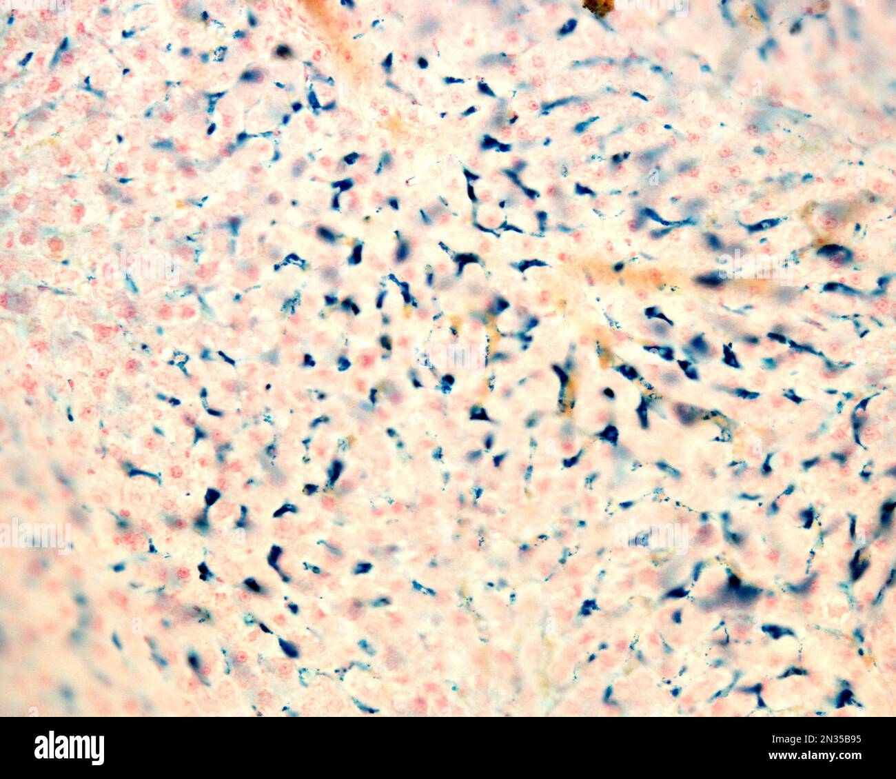 Le cellule di Kupffer sono macrofagi del fegato. Il ferro colloidale funge da colorante vitale che può essere introdotto nel corpo fagocitato dalle cellule di Kupffer, Foto Stock