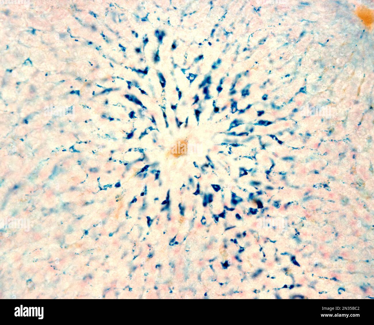 Le cellule di Kupffer sono macrofagi del fegato. Il ferro colloidale funge da colorante vitale che può essere introdotto nel corpo fagocitato dalle cellule di Kupffer, Foto Stock