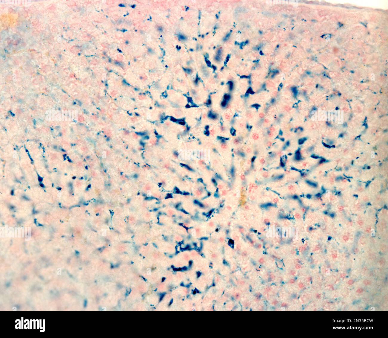 Le cellule di Kupffer sono macrofagi del fegato. Il ferro colloidale funge da colorante vitale che può essere introdotto nel corpo fagocitato dalle cellule di Kupffer, Foto Stock