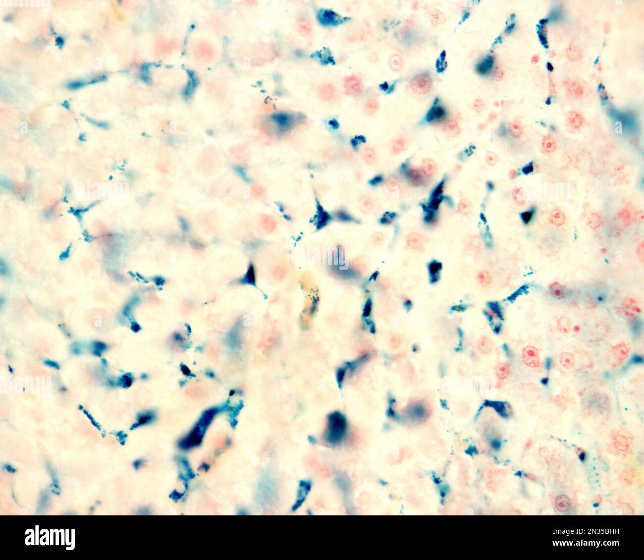 Le cellule di Kupffer sono macrofagi del fegato. Il ferro colloidale funge da colorante vitale che può essere introdotto nel corpo fagocitato dalle cellule di Kupffer, Foto Stock