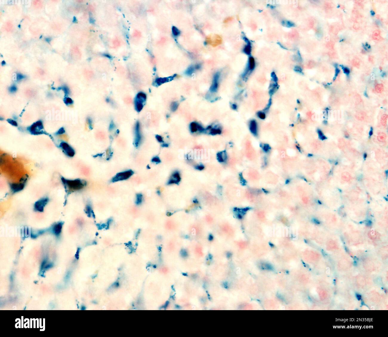 Le cellule di Kupffer sono macrofagi del fegato. Il ferro colloidale funge da colorante vitale che può essere introdotto nel corpo fagocitato dalle cellule di Kupffer, Foto Stock