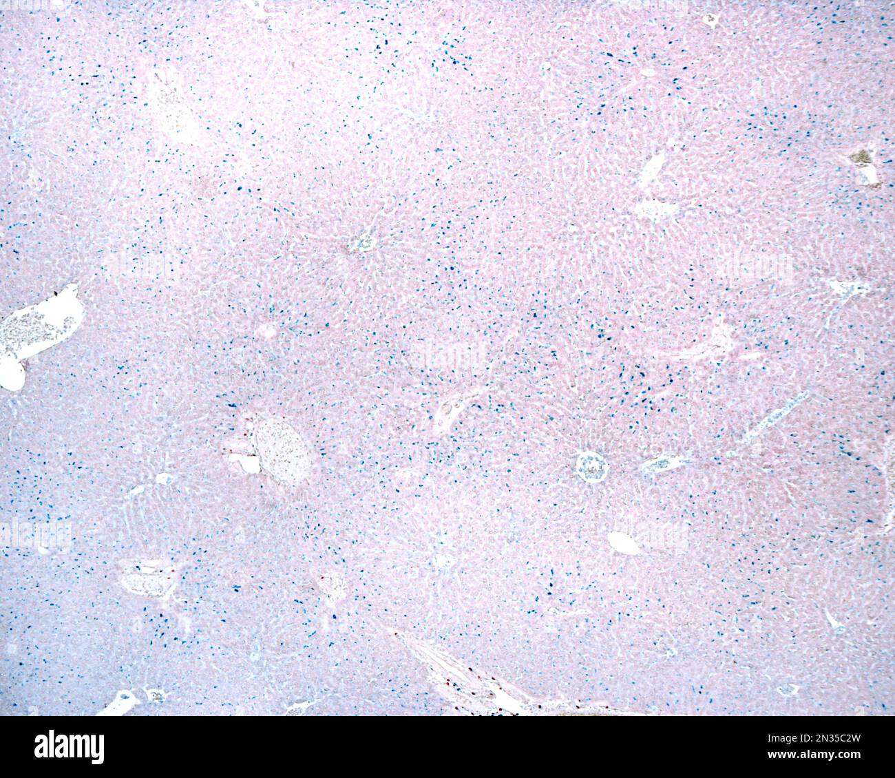Micrografia a basso ingrandimento di un fegato che mostra cellule Kupffer marcate in blu con la colorazione vitale Trypan blu, una colorazione vitale che agisce come un macrofo Foto Stock