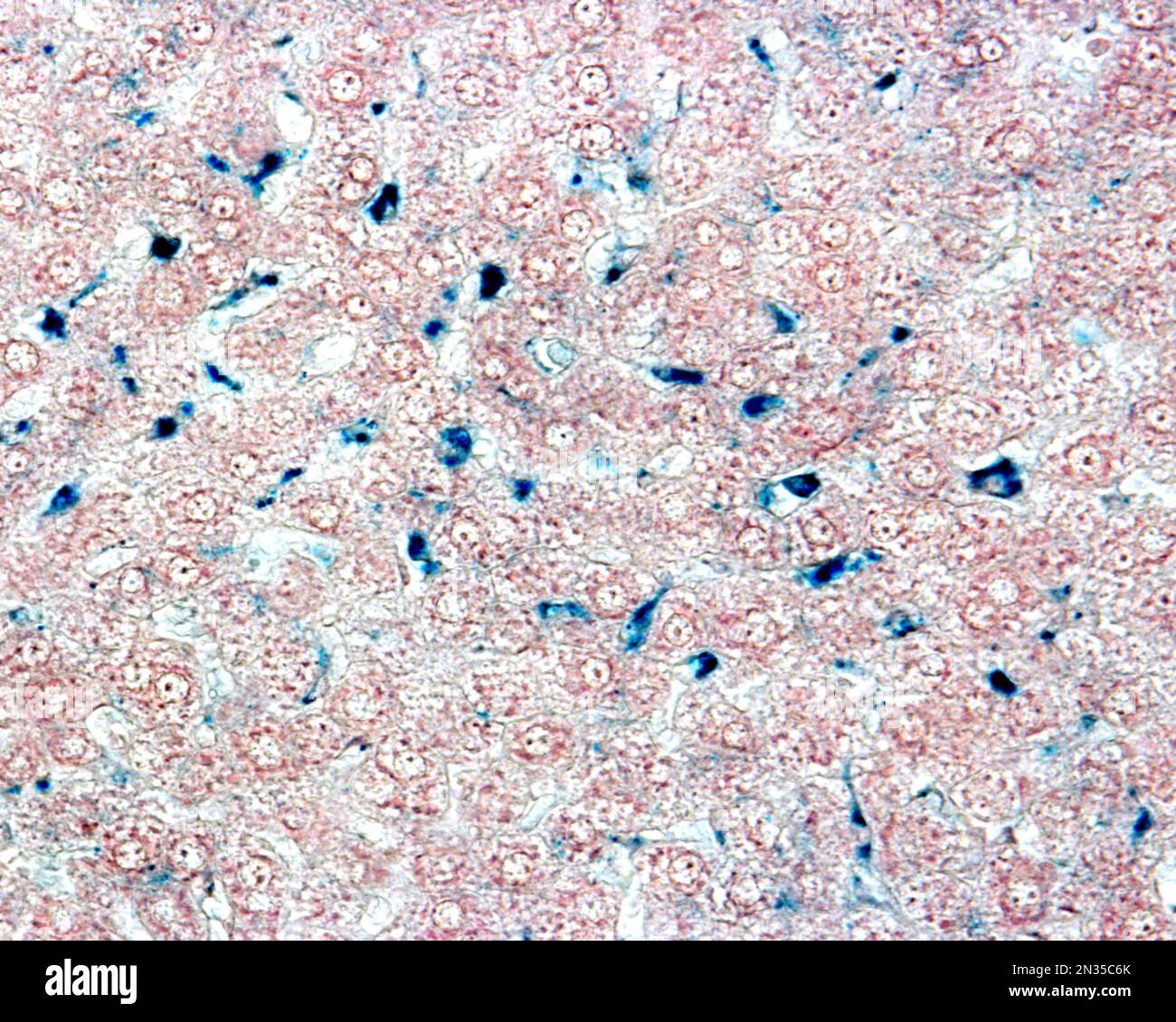 Le cellule epatiche di Kupffer sono macrofagi correlati alle sinusoidi epatiche. Quando le cellule di Kupffer fagocitano il blu di Trypan circolante, una macchia vitale che può b Foto Stock