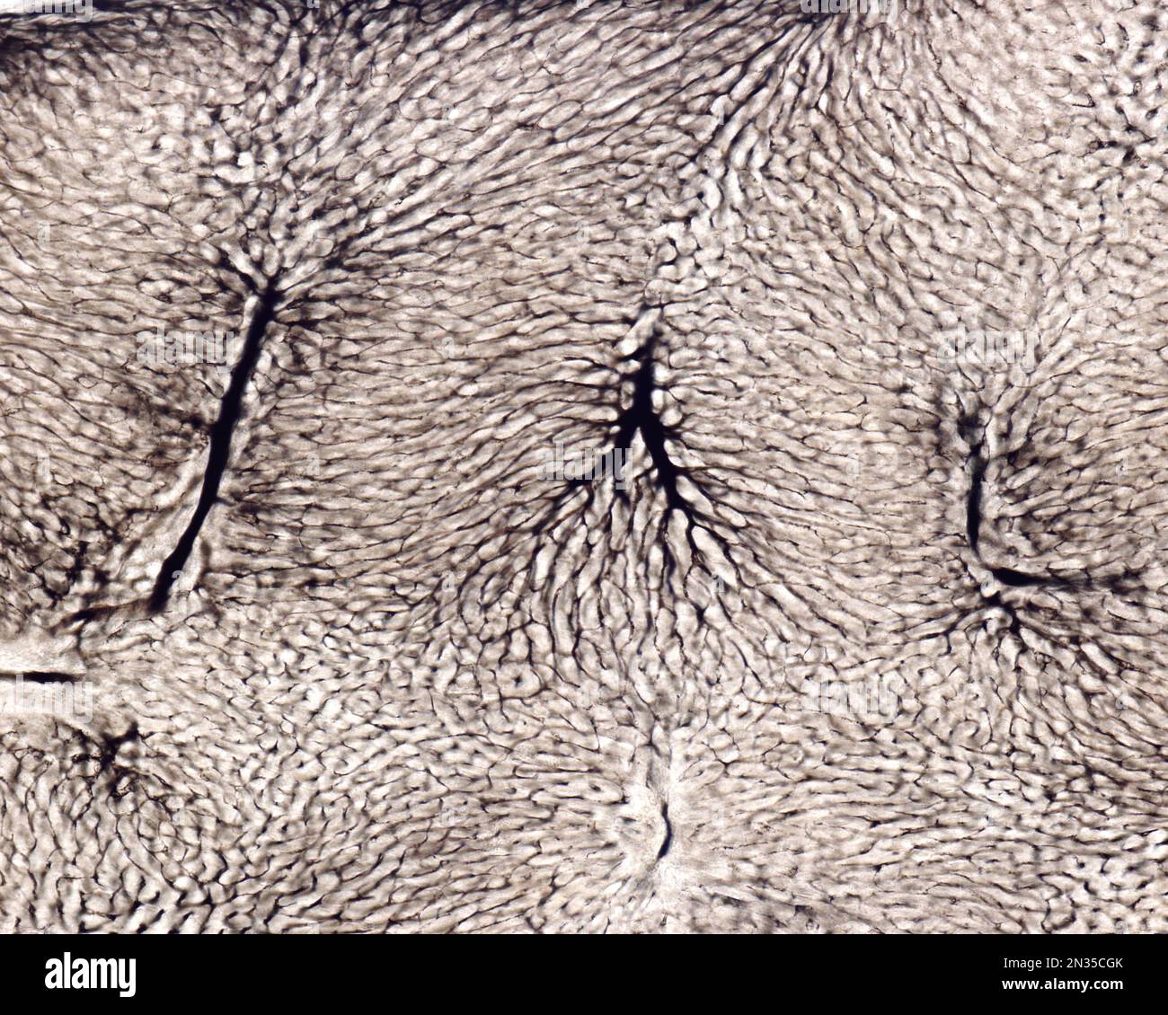 Lo studio di una microvascolatura d'organo implica di solito il riempimento dei vasi sanguigni con un'etichetta visibile al microscopio. Micrografia leggera di Liv Foto Stock