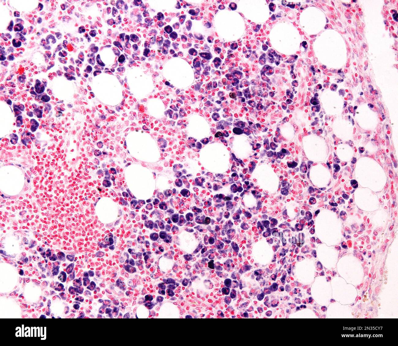 Macrofagi di una zona infiammatoria fortemente marcata con blu Trypan una macchia vitale che può essere introdotta nel corpo. Il Trypan blu circolante è phago Foto Stock