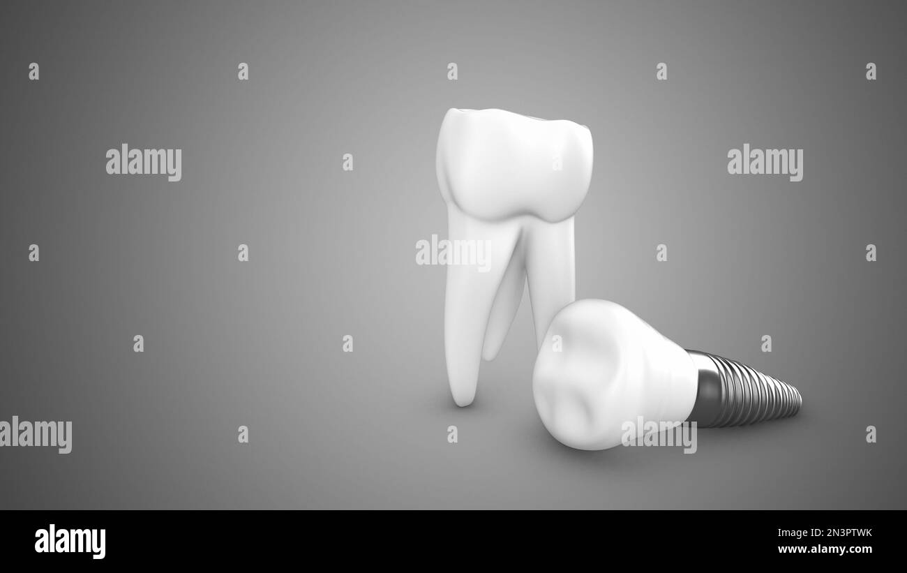 Denti umani e protesi Foto Stock