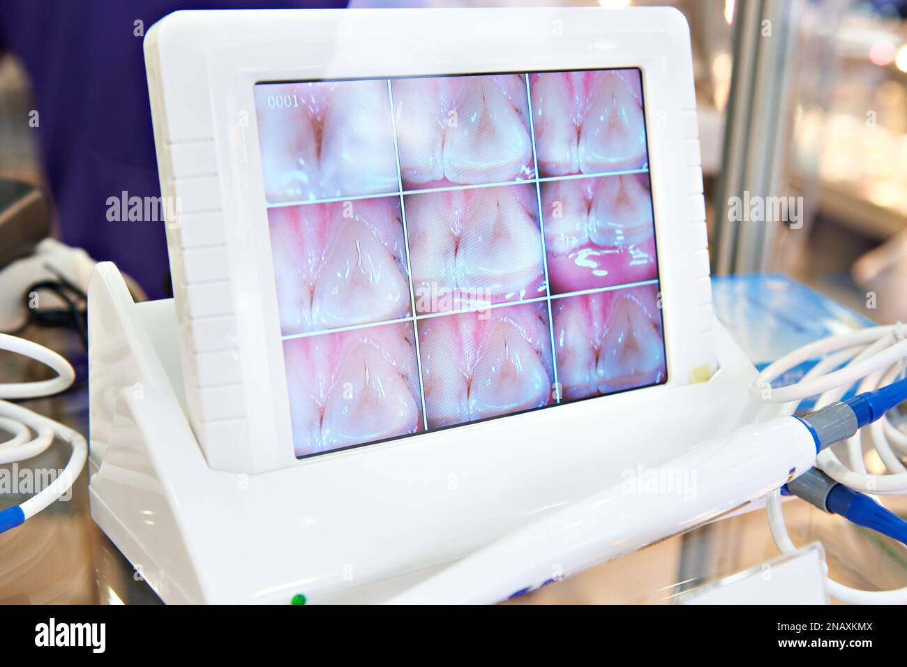 Moderna telecamera dentale con monitor Foto Stock