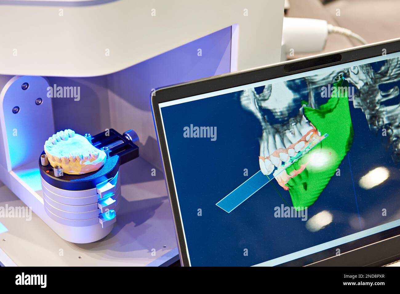 Moderna attrezzatura dentale per protesi dentarie e monitor Foto Stock