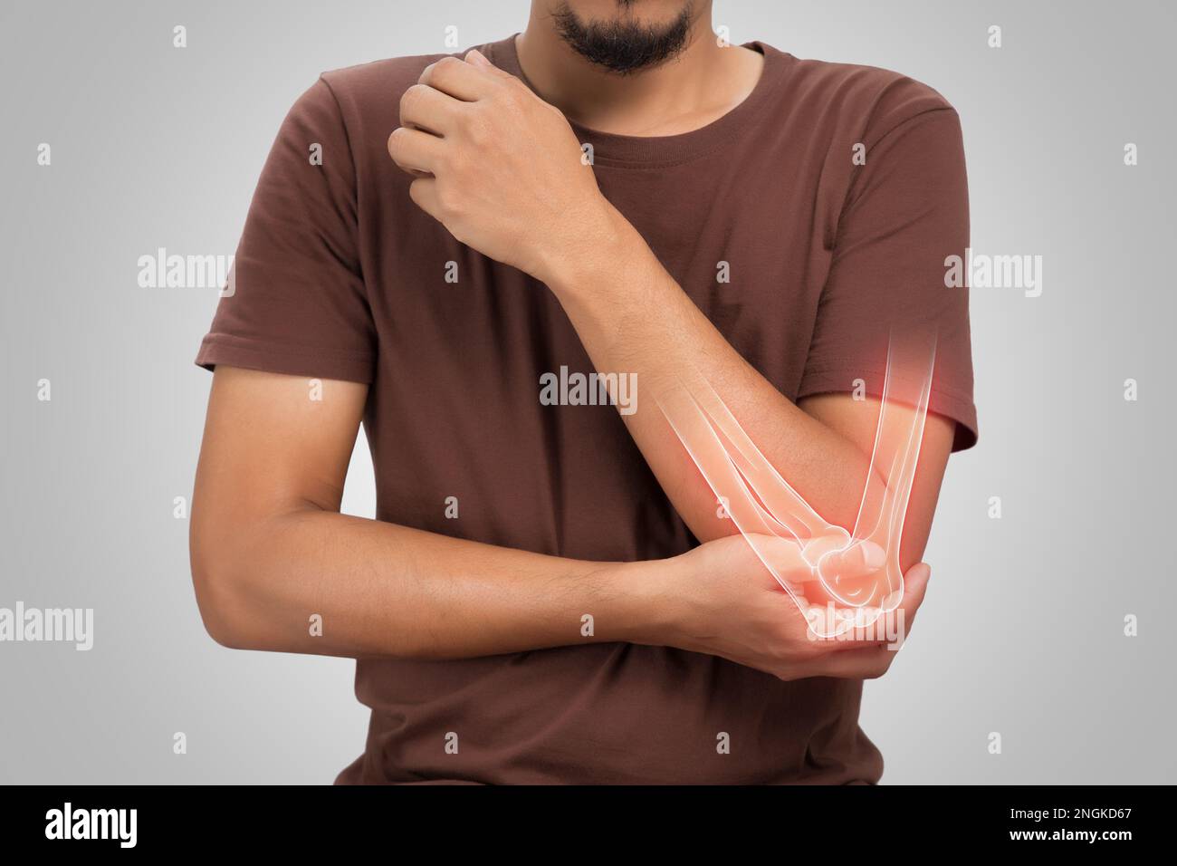 Un uomo gomito ossa dolore, persone che soffrono di dolore in cubito su uno sfondo grigio. Malattie dell'articolazione del gomito. Osteoartrite Foto Stock