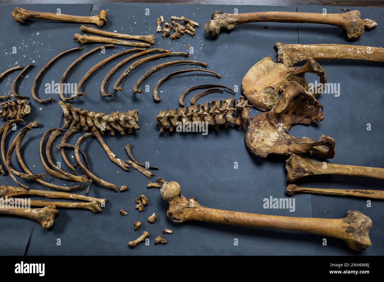 Patologo forense Dr. Raquel Fortun, Manila, Filippine, guerra alla droga Foto Stock