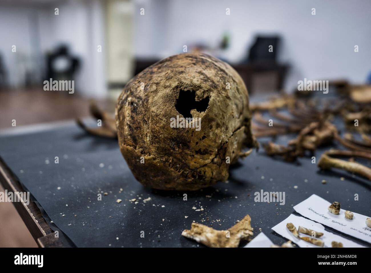 Patologo forense Dr. Raquel Fortun, Manila, Filippine, guerra alla droga Foto Stock