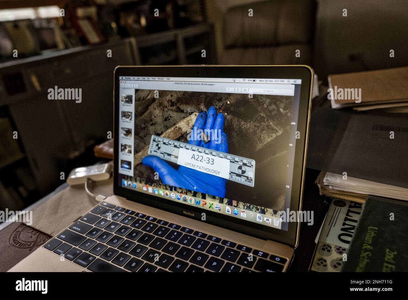 Patologo forense Dr. Raquel Fortun, Manila, Filippine, guerra alla droga Foto Stock