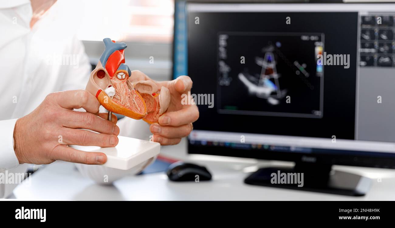 Modello anatomico del cuore umano nelle mani del medico. Consultazione cardiologica, trattamento delle malattie cardiache. Concetto medico Foto Stock