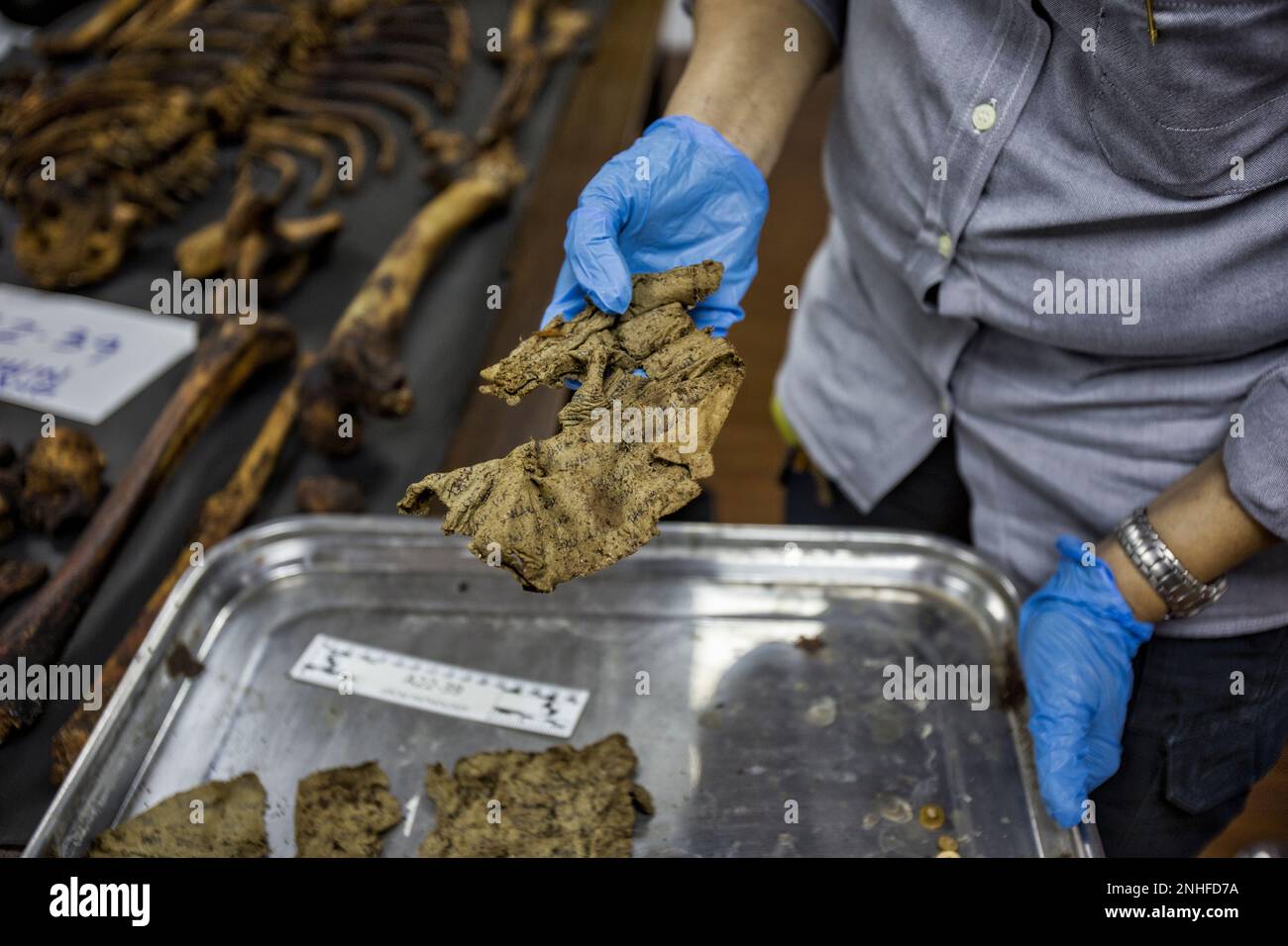 Raquel Fortun patologo forense, la guerra di Duterte contro la droga, Manila, Filippine Foto Stock