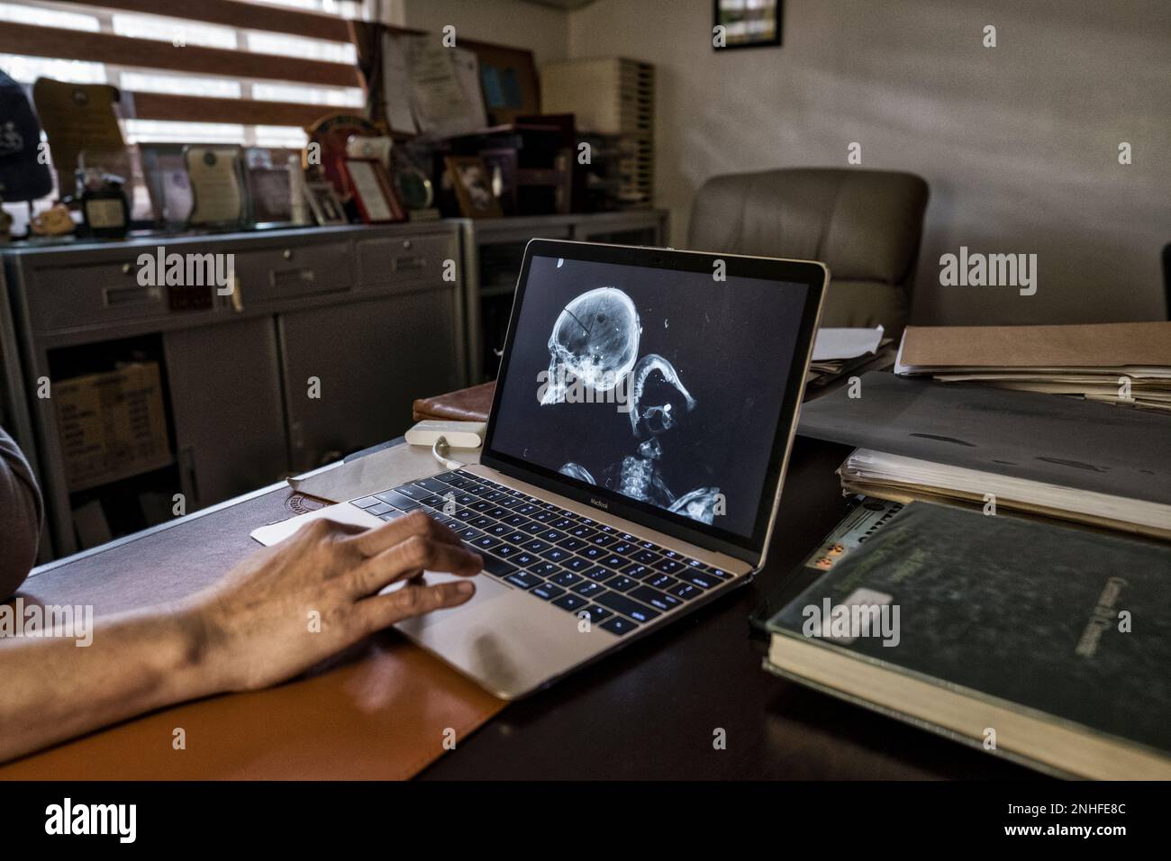 Raquel Fortun patologo forense, la guerra di Duterte contro la droga, Manila, Filippine Foto Stock