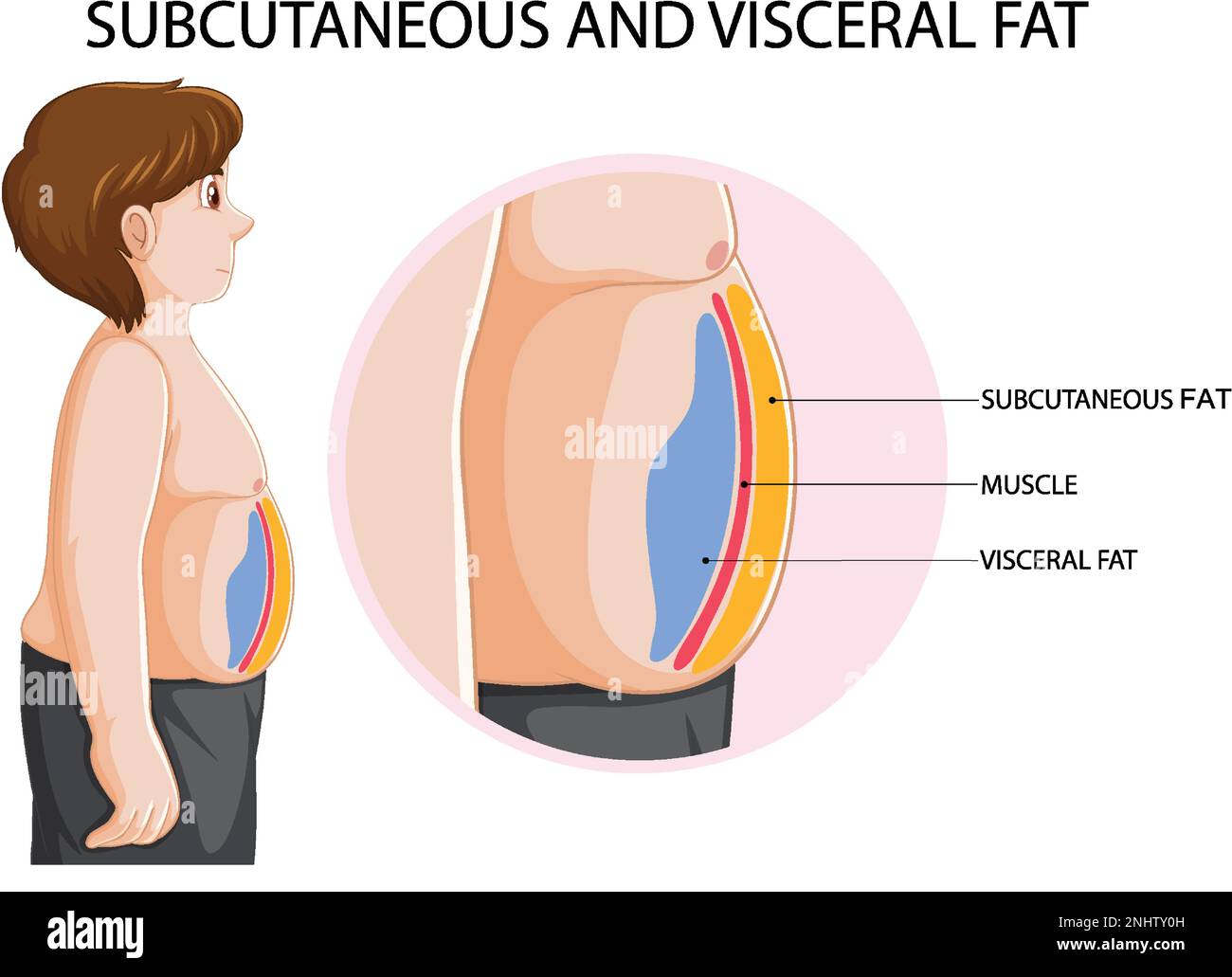 Illustrazione del diagramma del grasso sottocutaneo e viscerale Illustrazione Vettoriale