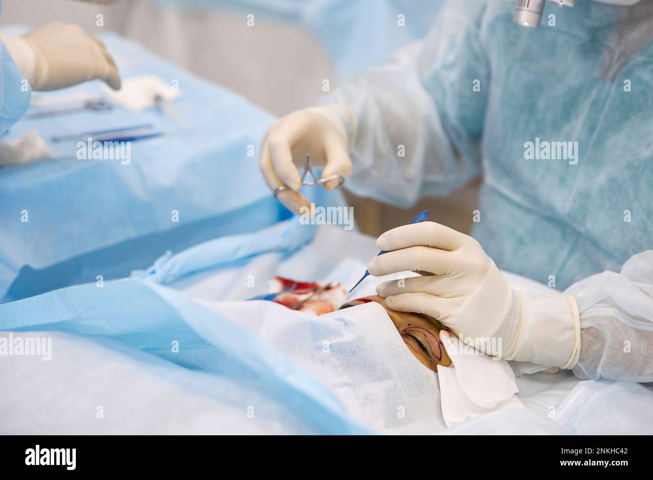 Dottore con strumenti che fanno chirurgia oculare su paziente in ospedale Foto Stock