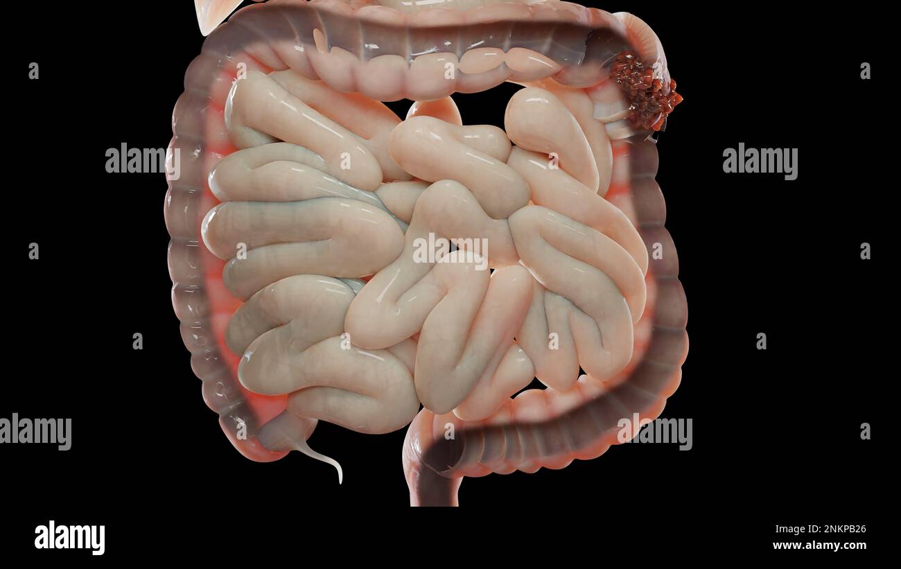 3d illustrazione dell'anatomia umana del sistema digestivo, concetto dell'intestino, lassativo, traitement della costipazione, 3d resa Foto Stock