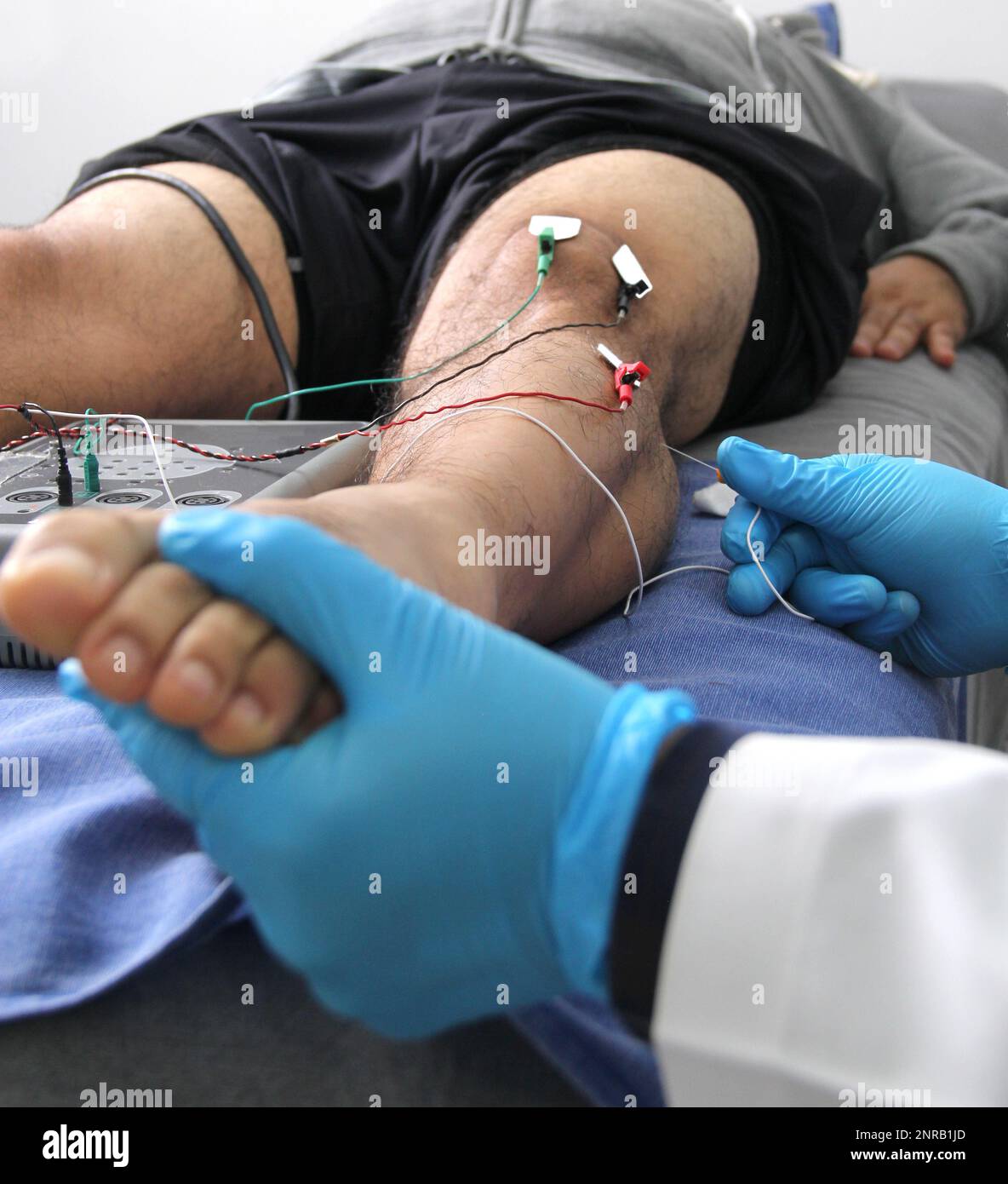 Elettromiografia EMG e potenziale evocato somatosensoriale PEV delle ...
