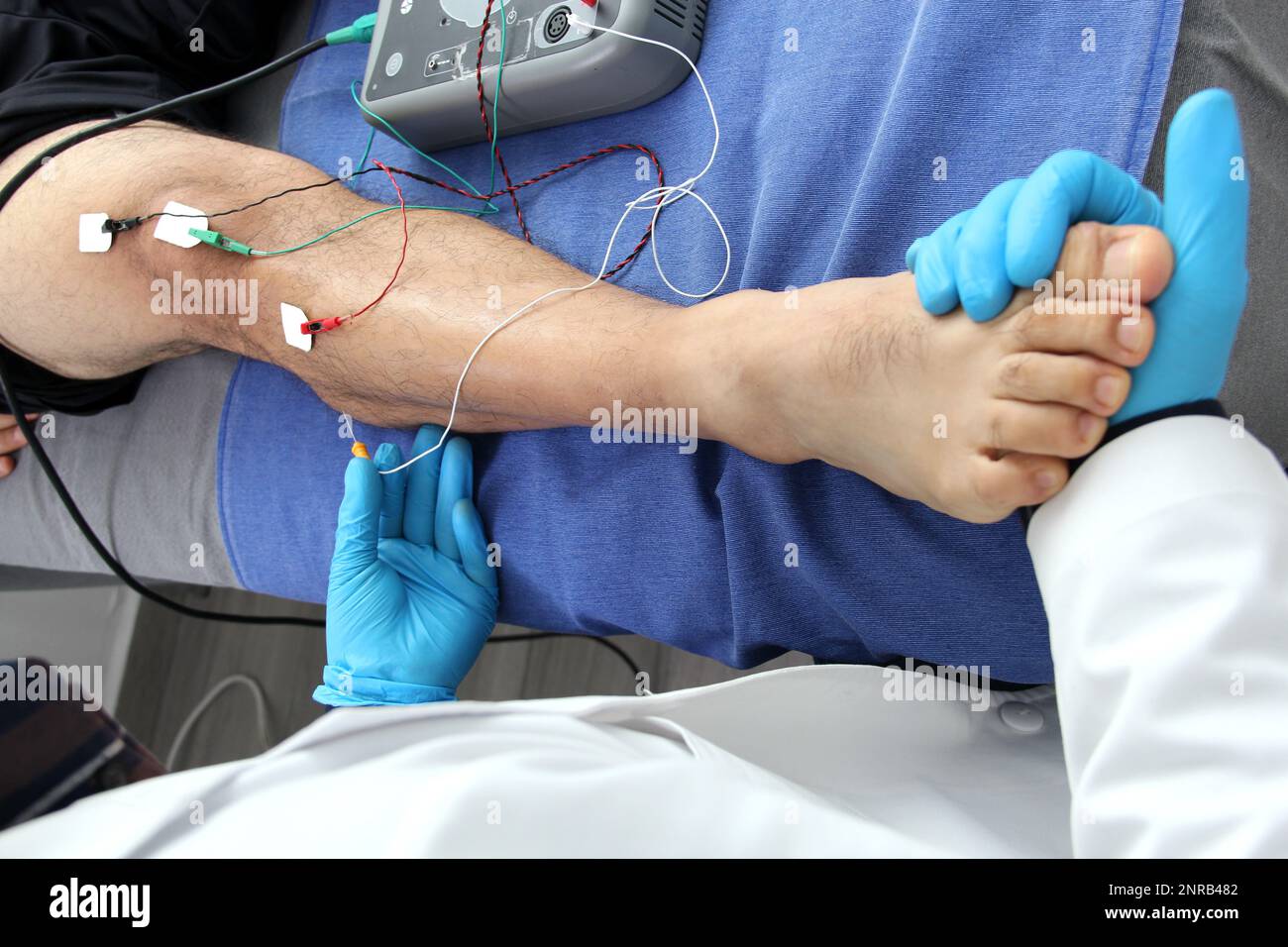 Elettromiografia EMG e potenziale evocato somatosensoriale PEV delle ...