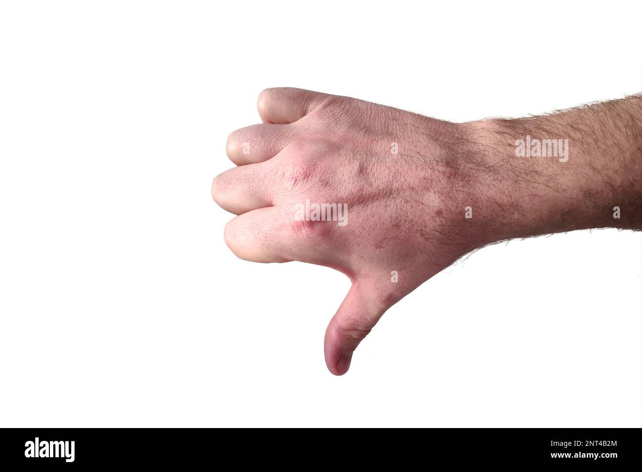 Mano maschio caucasica che fa un gesto di pollice verso il basso su sfondo bianco Foto Stock