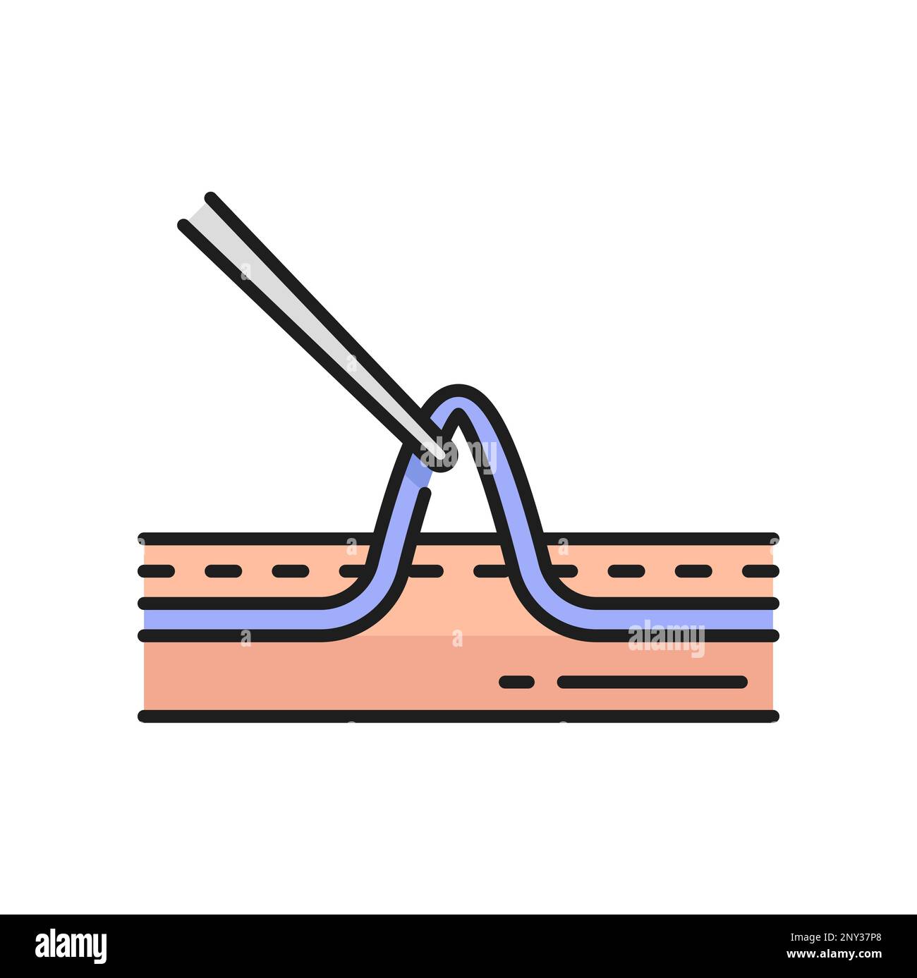 Chirurgia scleroterapica, iniezione di soluzione in vena attraverso catetere isolato icona contorno. Trattamento varicoso vettore e vene ragno procedura medica Illustrazione Vettoriale