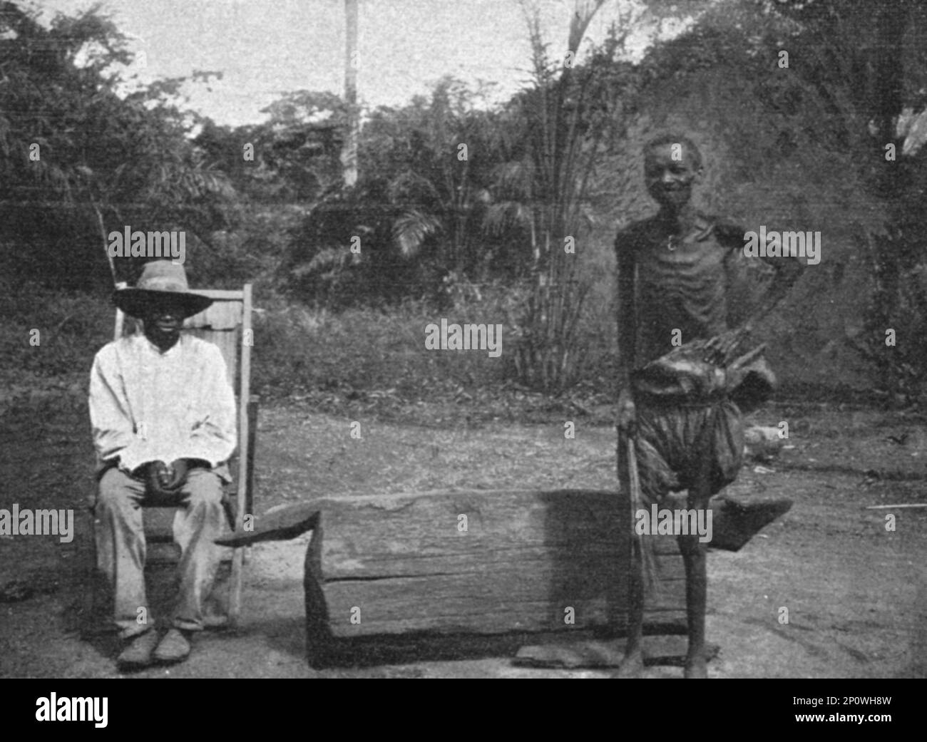 ''Indigene du Congo atteint de la maladie du sommeil; l'Ouest Africain', 1914. Da "Grande Geographie Bong Illustree", 1914. Foto Stock